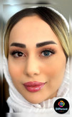 لنز رنگی فصلی مگنولیا یونیک