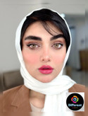 لنز رنگی فصلی فلامینگو یونیک