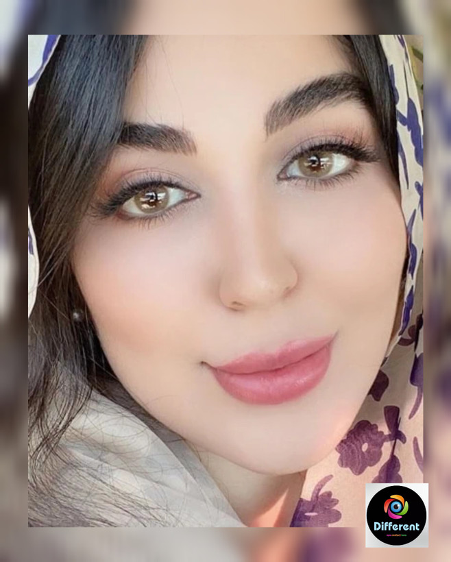 لنز رنگی فصلی و سالانه کرمی برند دهب (creamy)