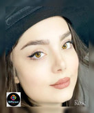 لنز رنگی رُز بزند یونیک