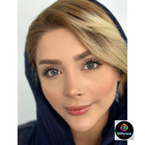 لنز رنگی ماداگاسکار برند آیس کالر (سورمه ای کهکشانی بافت دار)