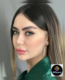 لنز رنگی وید گرین برند یونیک (سبز جنگلی تیله ای)